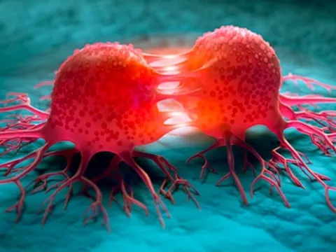 3 dấu hiệu vào buổi tối của người dễ mắc ung thư