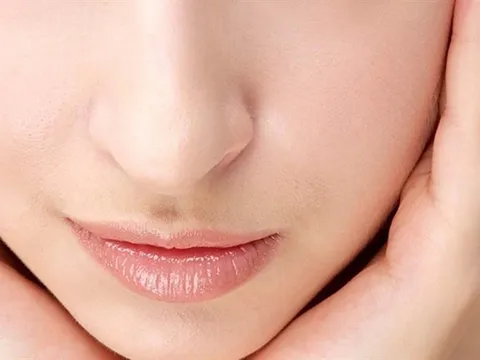 5 cách tự nhiên giúp làm mờ nếp nhăn khi cười và vùng mắt hiệu quả tại nhà