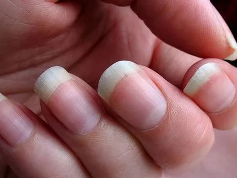 Tận dụng nước vo gạo để giúp móng tay chắc khỏe và bớt giòn gãy