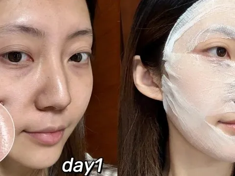 Blogger 28 tuổi dưỡng trắng da, mờ thâm nám nhờ routine khoa học tại nhà