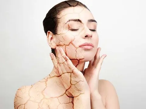 5 dấu hiệu lão hóa sớm có thể xuất hiện ngay từ tuổi 20 nhiều người không ngờ tới