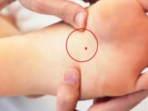 3 nốt ruồi vùng kín cực hút tài lộc: Ai có cả đời sống trong nhung lụa