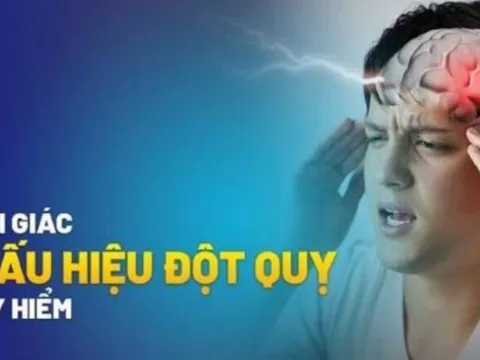 Dấu hiệu đột quỵ trước 1 tuần: Nhận biết sớm để tránh biến chứng nguy hiểm
