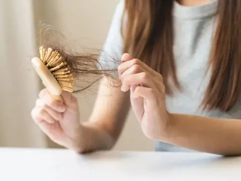 4 vấn đề da đầu âm thầm khiến tóc rụng nhiều hơn và cách xử lý đúng cách