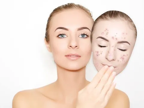 Giải cứu làn da xuống sắc sau Tết: Phục hồi đúng cách để da khỏe lại từ gốc