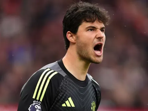 Nghệ thuật tuyển trạch của Tony Coton hồi sinh Man Utd thế nào?