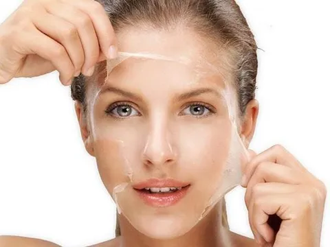 Thay đổi thói quen sống và skincare tối giản giúp cải thiện làn da dầu, giảm mụn ẩn