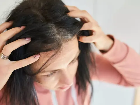 Tóc bạc nhiều hay ít có liên quan đến tuổi thọ? Bác sĩ nói ra sự thật khiến nhiều người bất ngờ