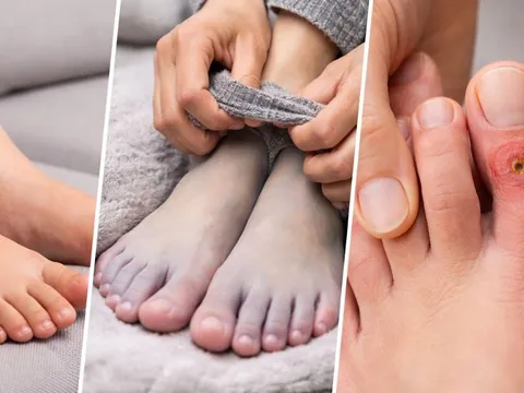 3 dấu hiệu ở chân có thể đang cảnh báo bệnh nguy hiểm, nhiều người thường bỏ qua