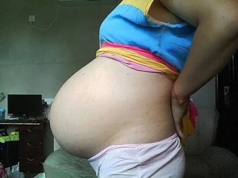 Cô gái trẻ bụng phình to như cái trống dù không hề mang bầu, kết quả chụp CT khiến ê-kíp bác sĩ tái mặt