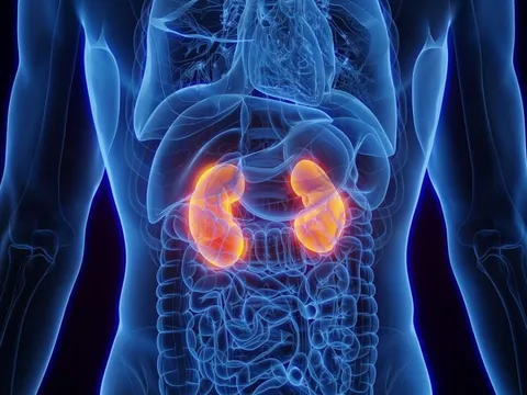 5 dấu hiệu bất thường khi ngủ cảnh báo suy thận: Đừng chủ quan kẻo chạy thận suốt đời