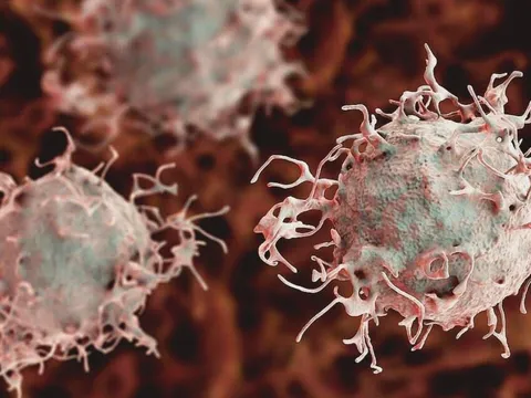 5 biểu hiện vào buổi sáng của người dễ bị ung thư