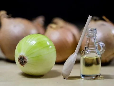 Nước ép hành tây có thực sự giúp kích thích mọc tóc?