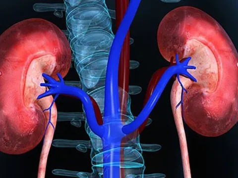 5 dấu hiệu khi ngủ cảnh báo chức năng thận suy yếu: Cẩn thận kẻo chạy thận suốt đời