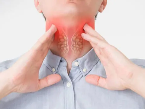 Bệnh viện K: 5 loại ung thư có khả năng chữa khỏi cao nhất