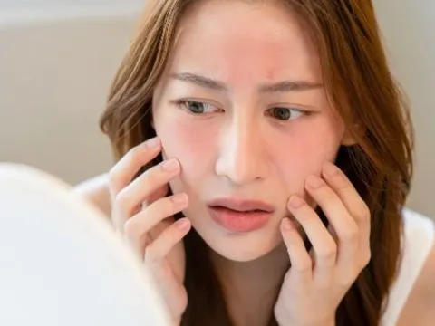 Điều gì xảy ra nếu không tẩy trang trước khi ngủ? Những tác động âm thầm khiến da xuống cấp