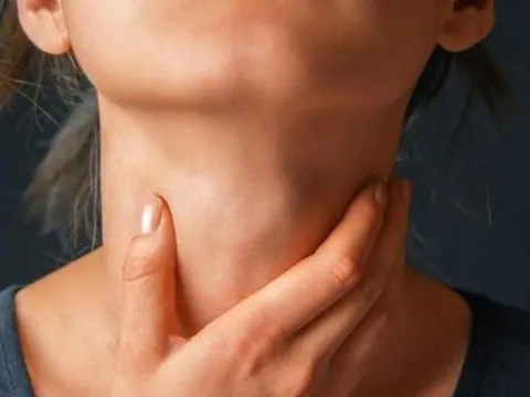 5 dấu hiệu rõ ràng của người bị cường giáp: Đặc biệt biểu hiện số 2