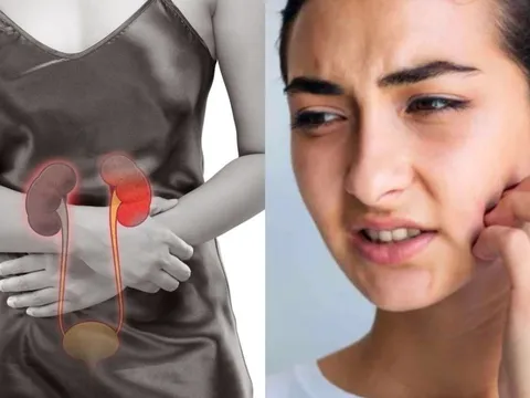 5 dấu hiệu trên mặt cảnh báo suy thận đang âm thầm xảy ra