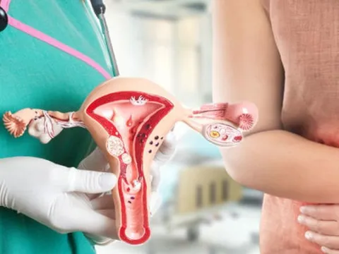 5 dấu hiệu ung thư cổ tử cung dễ nhận biết nhất: Đặc biệt dấu hiệu số 2