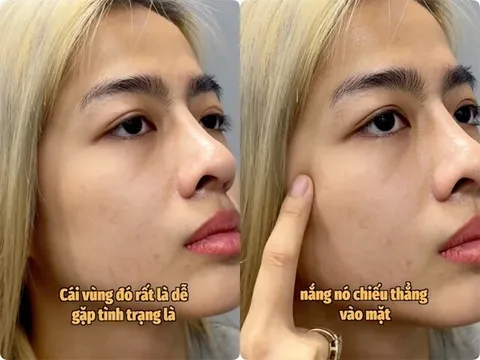 Tuyệt chiêu bôi kem chống nắng “2 lớp” của KOC Quỳnh Như Nguyễn: Tại sao vùng gò má cần được bảo vệ gấp đôi?