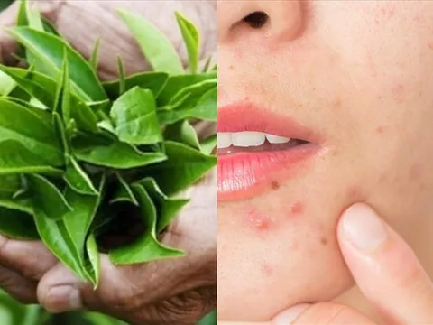 Trà xanh và làn da: lợi ích nổi bật cùng cách sử dụng đúng để hỗ trợ chống lão hóa