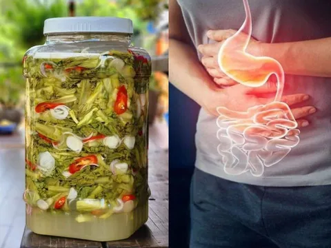 5 thực phẩm càng ăn nhiều càng dễ bị ung thư dạ dày