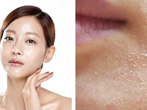 6 dấu hiệu khiến gương mặt trông già hơn tuổi và cách cải thiện hiệu quả