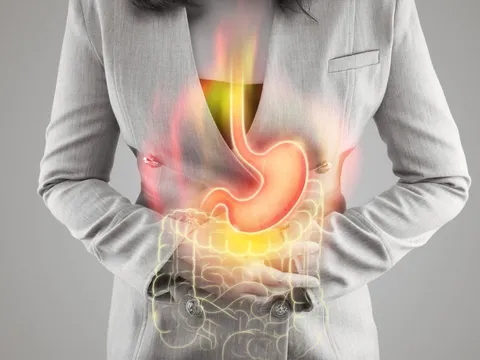 6 loại đồ uống giúp giảm trào ngược axit dạ dày thực quản