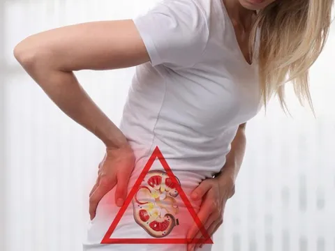 5 dấu hiệu suy thận rõ nhất, thấy 1/5 phải gặp bác sĩ ngay