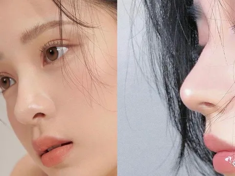 2 loại serum nên có trong chu trình skincare để duy trì làn da căng mịn, tươi trẻ