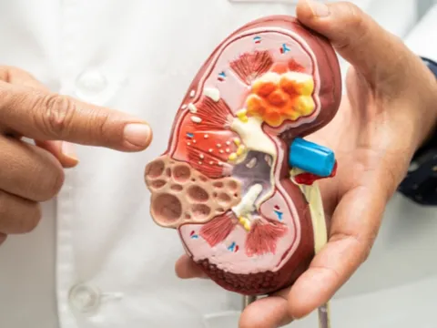 5 biểu hiện vào ban đêm cảnh báo suy thận giai đoạn sớm