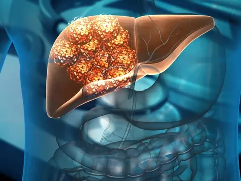 5 dấu hiệu vào ban đêm của người suy gan nặng