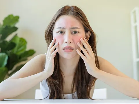 Da chảy xệ: Nguyên nhân và 5 nguyên liệu tự nhiên giúp cải thiện độ săn chắc