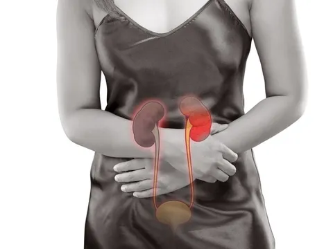 5 dấu hiệu bạn mắc bệnh suy thận: Có 1 cũng nên đi khám sớm