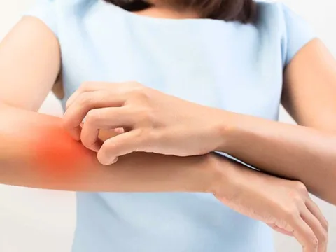 10 triệu chứng xuất hiện trên da cảnh báo tình trạng sức khỏe có vấn đề, cần đến viện kiểm tra sớm