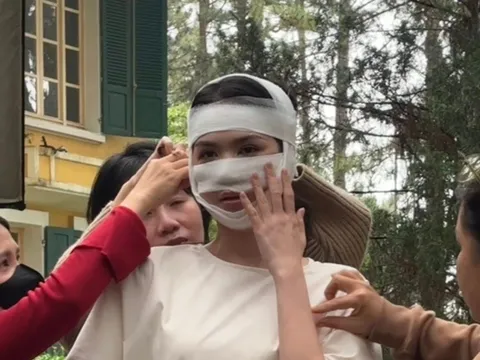 Hình ảnh Ngọc Trinh băng bó kín cả mặt gây hoang mang