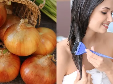 Nước ép hành tây có thực sự giúp mọc tóc? Cách dùng đúng để tránh kích ứng da đầu