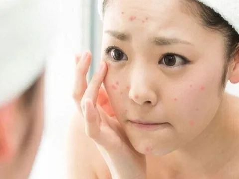 Cô gái mang túi mỹ phẩm mua online đến cầu cứu bác sĩ vì mặt bị dị ứng sau vài lần sử dụng