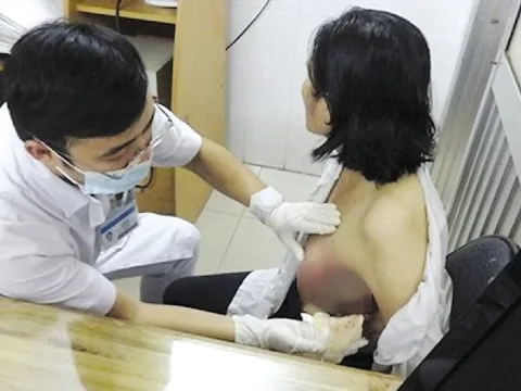 5 dấu hiệu nhận biết ung thư vú từ sớm, số 1 biết sớm chữa được ngay