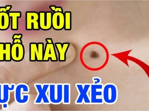 3 nốt ruồi xui xẻo cản trở tài lộc: Nên tìm cách hóa giải kẻo cả đời không ngóc đầu lên được