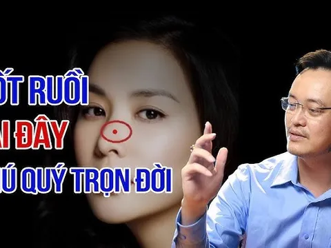 3 nốt ruồi may mắn giàu sang trọn đời
