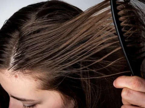 3 thói quen tưởng vô hại khiến tóc nhanh bết và da đầu dễ đổ dầu