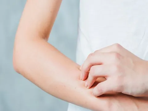 5 dấu hiệu bệnh tiểu đường: Nên đi khám sớm