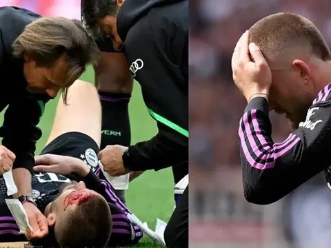 Eric Dier đổ máu khi cứu bóng ngay trên vạch vôi