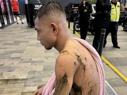 Cầu thủ Malaysia bị tạt axit, HLV Guinea nhận xét về U23 Indonesia