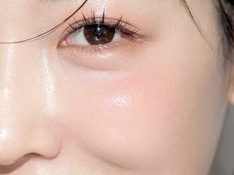 Mỡ lợn có thực sự tốt cho da? Cách dùng đúng để dưỡng ẩm và phục hồi hiệu quả