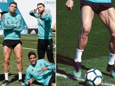 10 danh thủ sở hữu bắp chân 'cực dị': CR7 và 'mục tiêu' của Man Utd