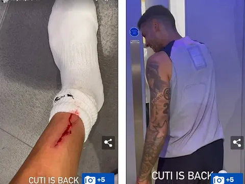 Sao Tottenham đổ máu sau cú vào bóng của đồng đội