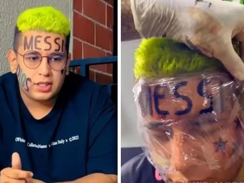 Chàng trai hối hận vì xăm chữ 'Messi' khổng lồ lên trán