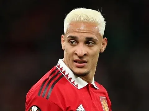 'Đứa trẻ lên 5 cũng làm được như Antony'